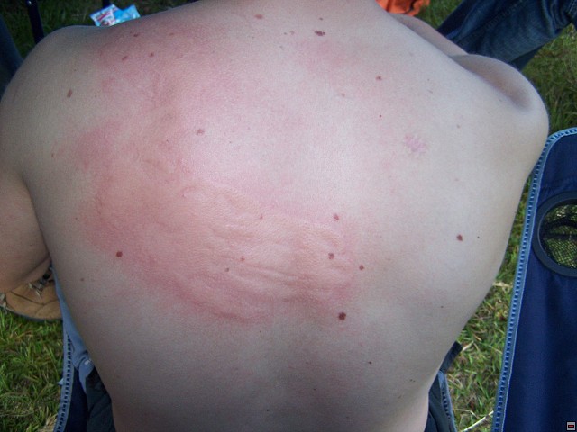 img00025.jpg
